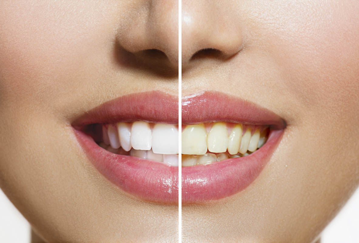 Before and After Dental Care
